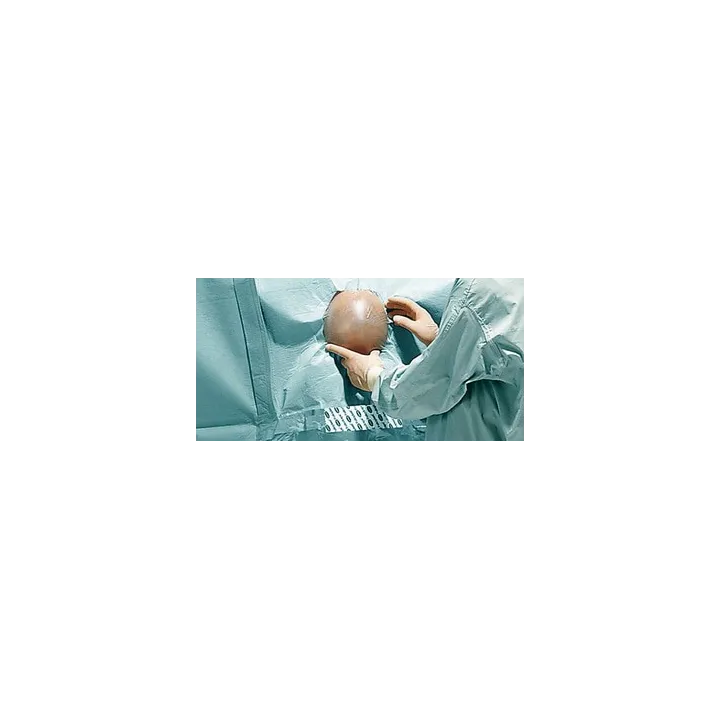 HARTMANN Foliodrape Protect Plus Angiographie-Set I ung à 5 Sets